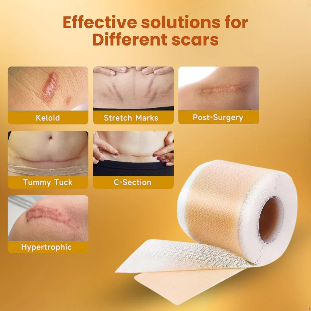 Silicone Scar Tape