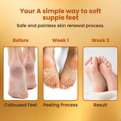 Foot Peeling and Exfoliating Mask - Made In Korea