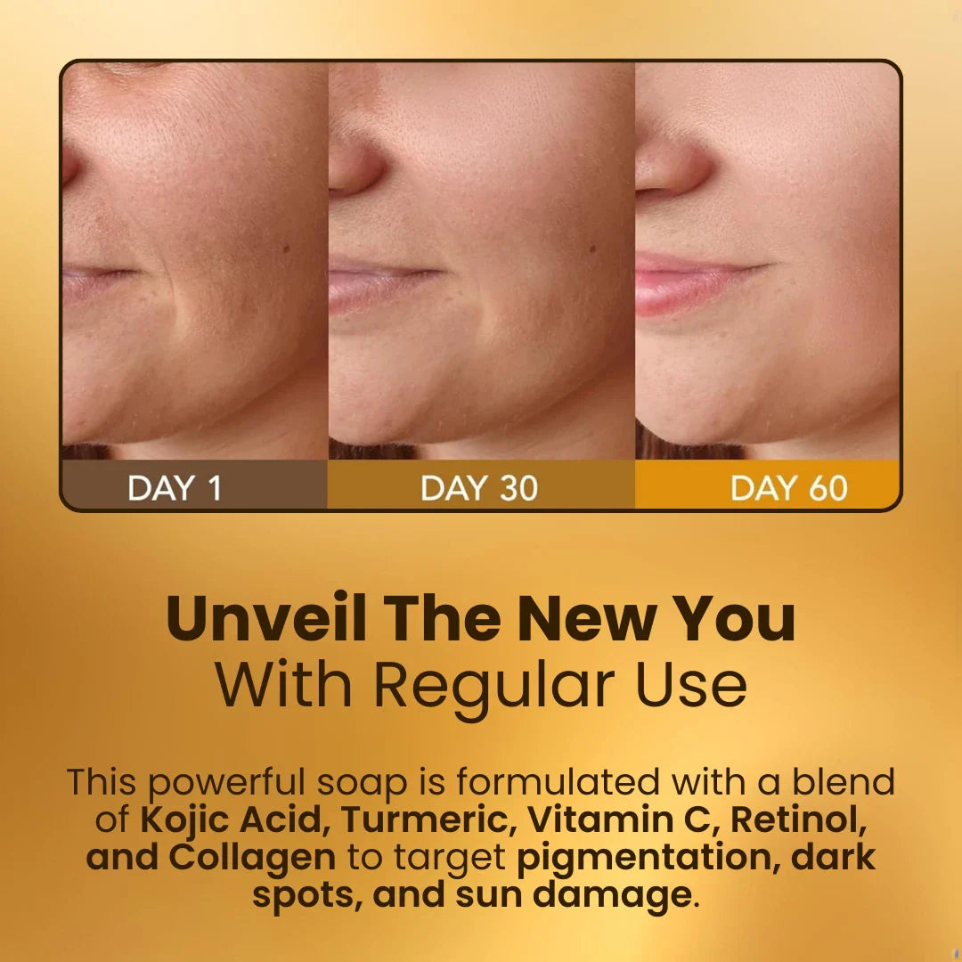 Kojic Acid & Turmeric Soap Bar