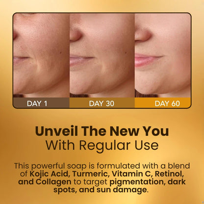 Kojic Acid & Turmeric Soap Bar