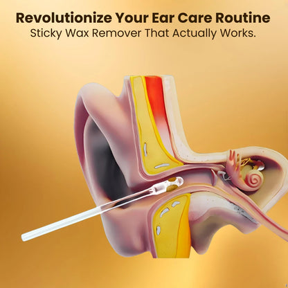 Sticky Reusable Ear Wax Remover (24 Pcs)