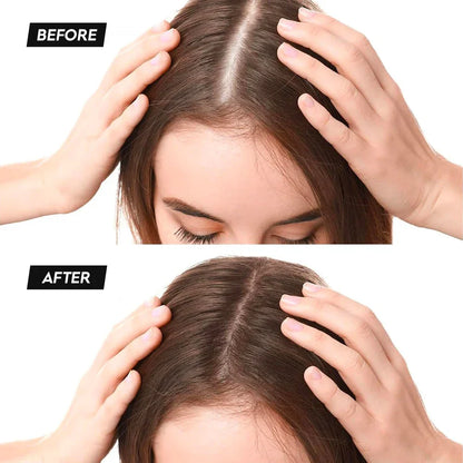 Elite Beauty Hair Thickening Fibers - Black